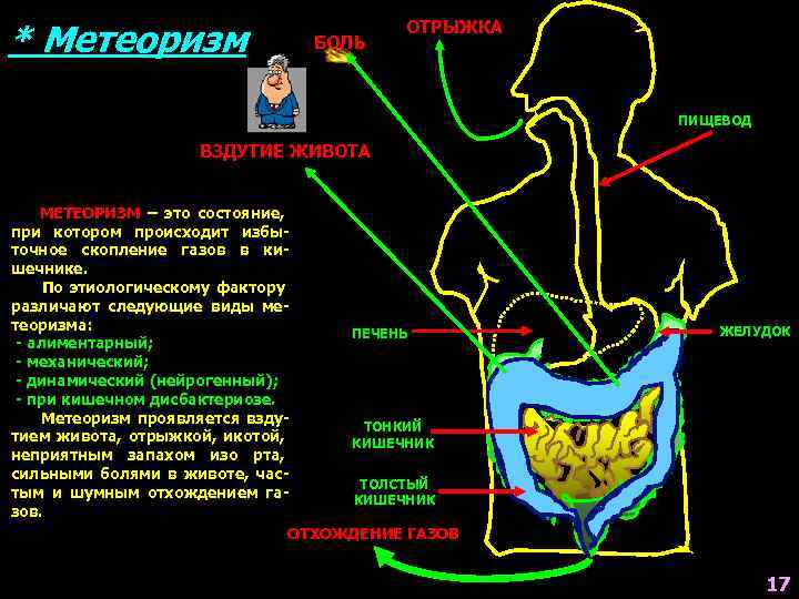 * Метеоризм БОЛЬ ОТРЫЖКА ПИЩЕВОД ВЗДУТИЕ ЖИВОТА МЕТЕОРИЗМ – это состояние, при котором происходит
