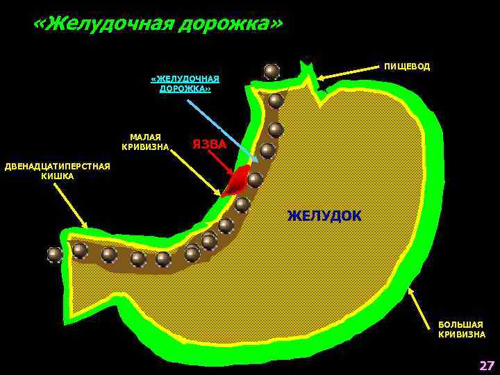  «Желудочная дорожка» ПИЩЕВОД «ЖЕЛУДОЧНАЯ ДОРОЖКА» МАЛАЯ КРИВИЗНА ТРАВМА ЯЗВА ДВЕНАДЦАТИПЕРСТНАЯ КИШКА ЖЕЛУДОК БОЛЬШАЯ