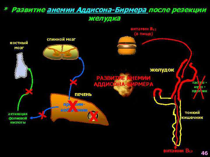 * Развитие анемии Аддисона-Бирмера после резекции желудка витамин В 12 (в пище) костный мозг