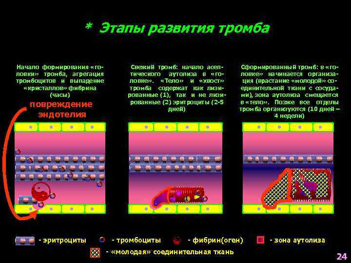 * Этапы развития тромба Начало формирования «головки» тромба, агрегация тромбоцитов и выпадение «кристаллов» фибрина