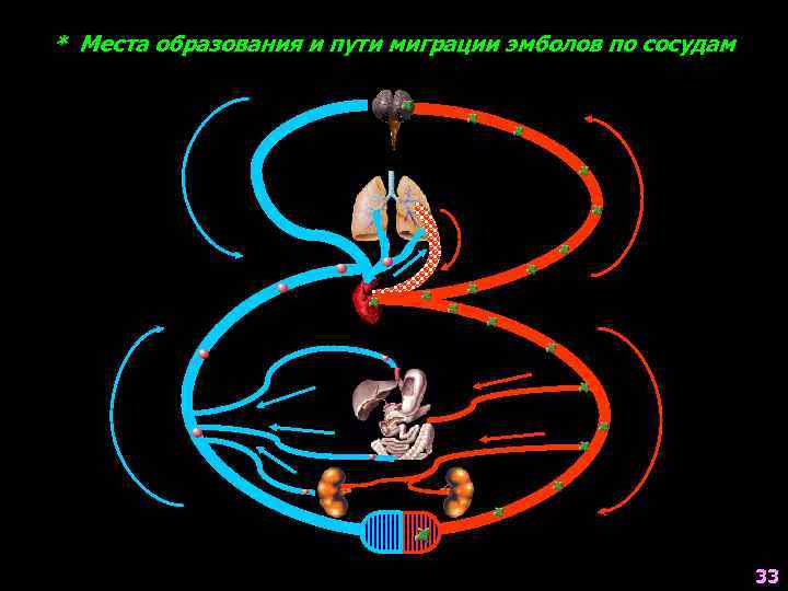 * Места образования и пути миграции эмболов по сосудам 33 