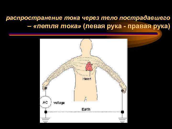 Ток прошел через тело. Распространение тока. Петли тока в теле человека. Петля тока это в медицине. Движение тока через тело.