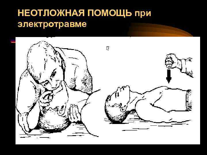 НЕОТЛОЖНАЯ ПОМОЩЬ при электротравме 