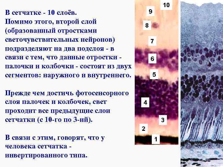 9 В сетчатке - 10 слоёв. Помимо этого, второй слой (образованный отростками светочувствительных нейронов)