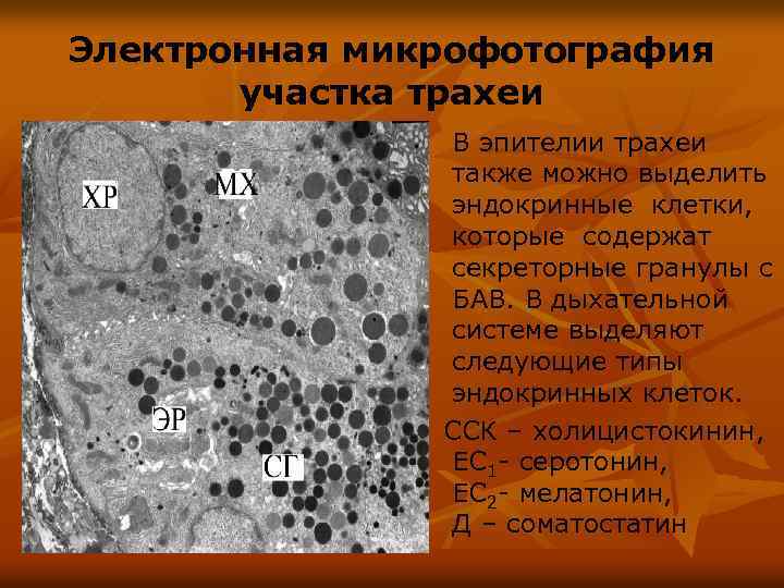 Электронная микрофотография участка трахеи В эпителии трахеи также можно выделить эндокринные клетки, которые содержат