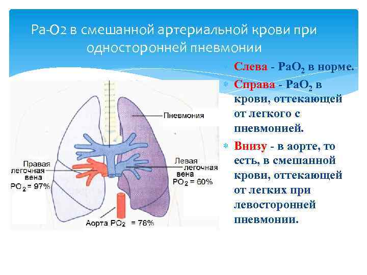 Ра-О 2 в смешанной артериальной крови при односторонней пневмонии Слева - Ра. О 2