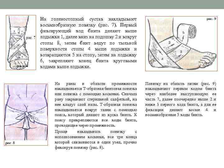 На голеностопный сустав накладывают восьмиобразную повязку (рис. 7). Первый фиксирующий ход бинта делают выше