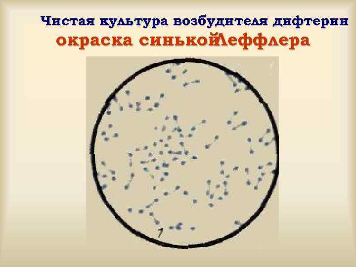 Схема микробиологической диагностики микозов