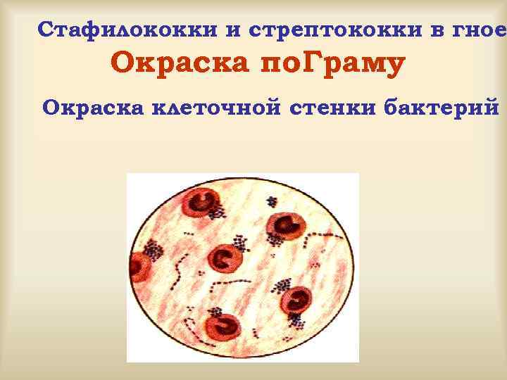 Стафилококки и стрептококки в гное Окраска по. Граму Окраска клеточной стенки бактерий 
