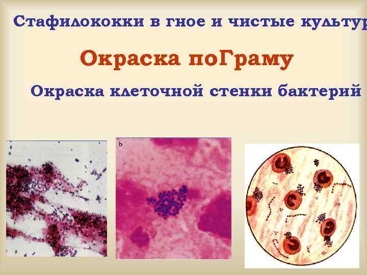 Стафилококки в гное и чистые культур Окраска по. Граму Окраска клеточной стенки бактерий 
