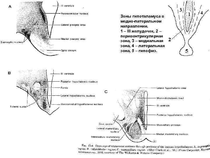 Зоны гипоталамуса в медио-латеральном направлении. 1 – III желудочек, 2 – перивентрикулярная зона, 3