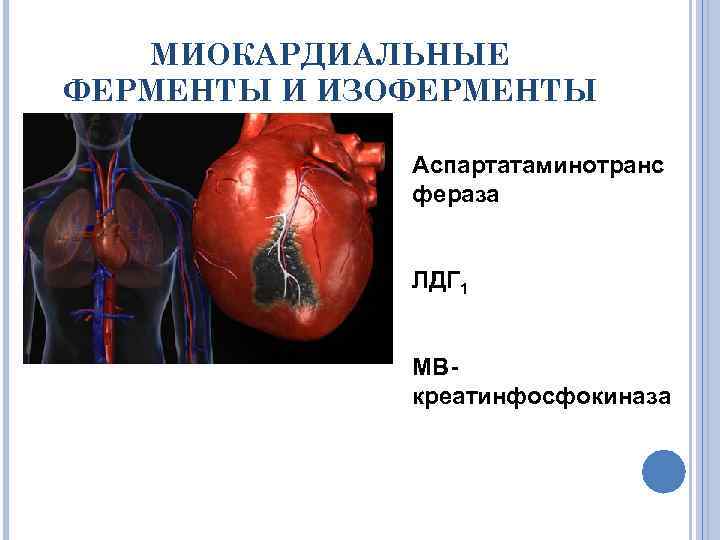 МИОКАРДИАЛЬНЫЕ ФЕРМЕНТЫ И ИЗОФЕРМЕНТЫ Аспартатаминотранс фераза ЛДГ 1 МВкреатинфосфокиназа 
