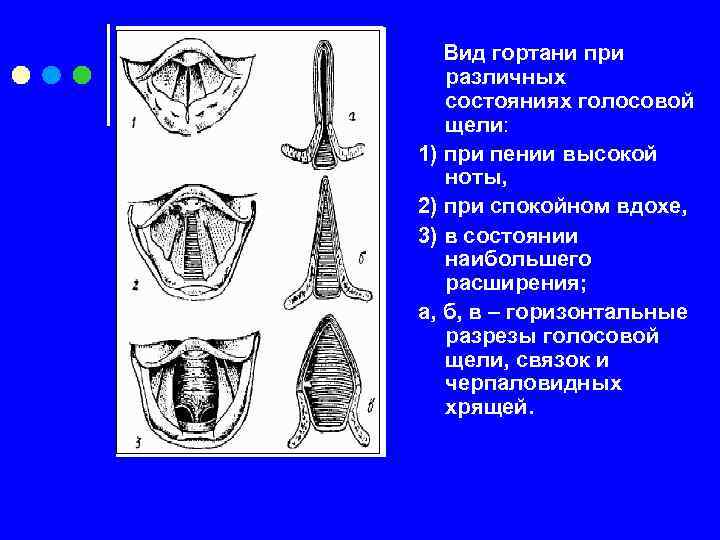 Вид гортани при различных состояниях голосовой щели: 1) при пении высокой ноты, 2) при
