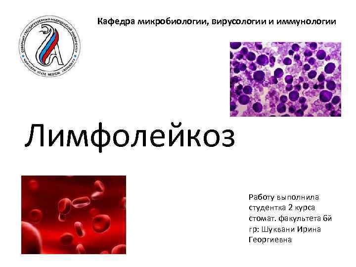 Кафедра микробиологии, вирусологии и иммунологии Лимфолейкоз Работу выполнила студентка 2 курса стомат. факультета 6