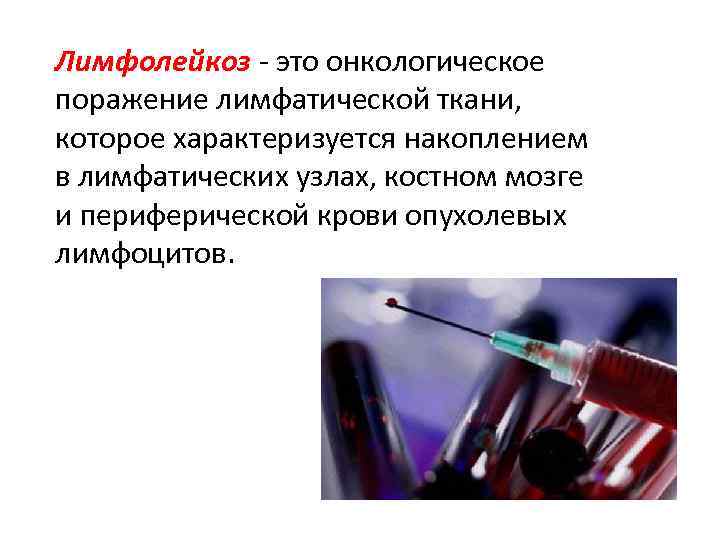Лимфолейкоз - это онкологическое поражение лимфатической ткани, которое характеризуется накоплением в лимфатических узлах, костном