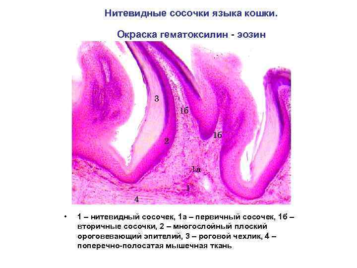 Нитевидные сосочки языка кошки. Окраска гематоксилин - эозин • 1 – нитевидный сосочек, 1