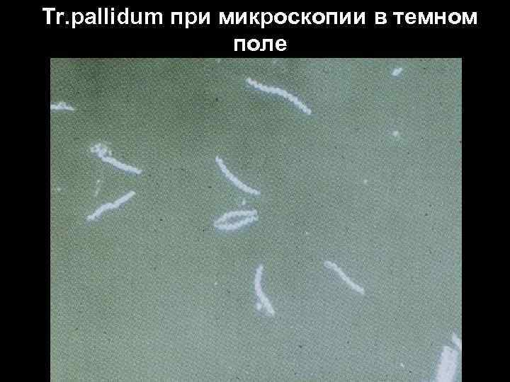 Tr. pallidum при микроскопии в темном поле 