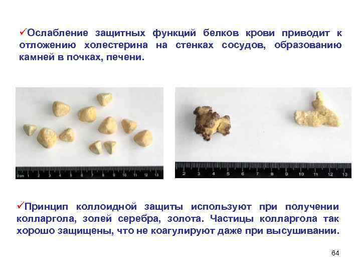 üОслабление защитных функций белков крови приводит к отложению холестерина на стенках сосудов, образованию камней