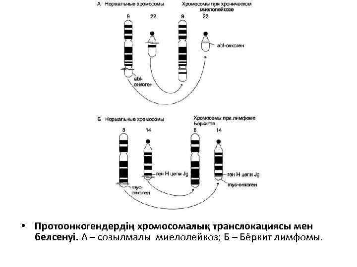  • Протоонкогендердің хромосомалық транслокациясы мен белсенуі. А – созылмалы миелолейкоз; Б – Бёркит