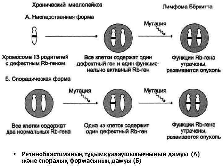  • Ретинобластоманың тұқымқуалаушылығныңың дамуы (А) және споралық формасының дамуы (Б) 