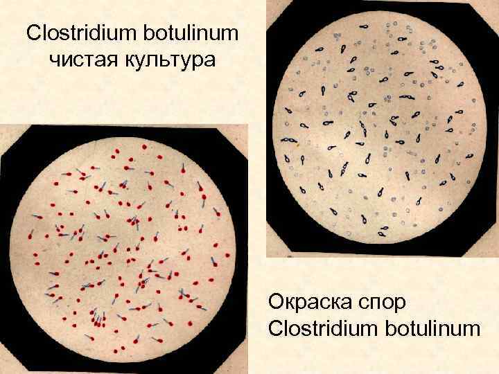 Кластридии. Клостридии ботулизма ( Clostridium botulinum ) ботулизм. Морфология клостридии перфрингенс. Клостридия Ожешко. Клостридия перфрингенс по Граму.
