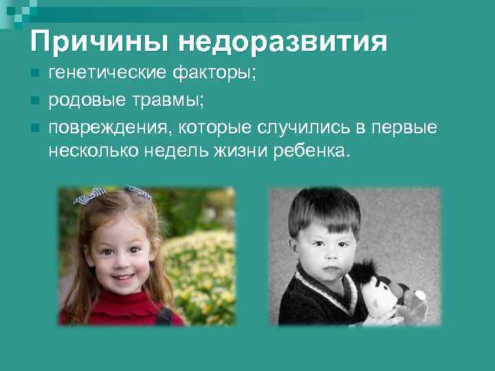 Причины недоразвития n n n генетические факторы; родовые травмы; повреждения, которые случились в первые