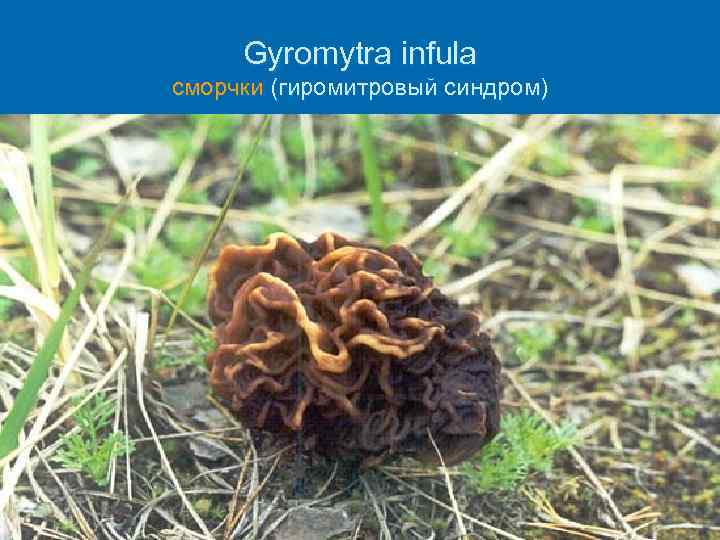 Gyromytra infula cморчки (гиромитровый синдром) 
