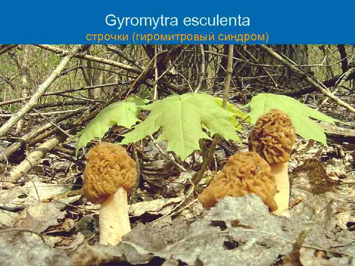 Gyromytra esculenta строчки (гиромитровый синдром) 