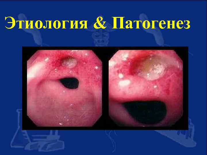 Этиология & Патогенез 