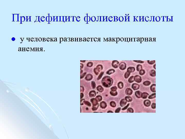 При дефиците фолиевой кислоты l у человека развивается макроцитарная анемия. 