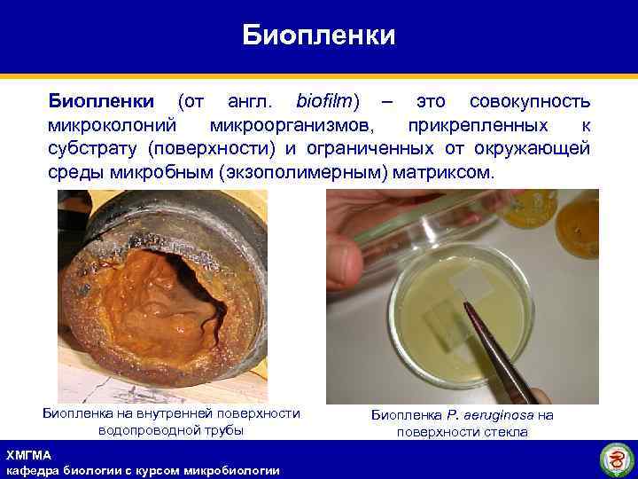 Биопленки (от англ. biofilm) – это совокупность микроколоний микроорганизмов, прикрепленных к субстрату (поверхности) и