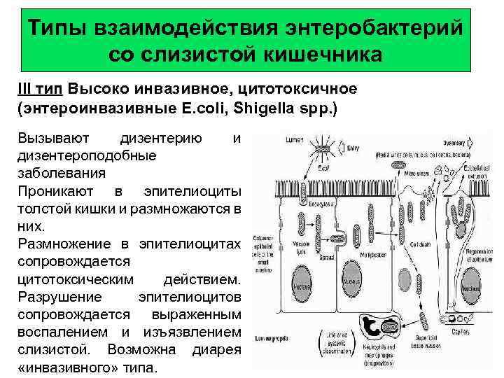 Тип 3 кишечная