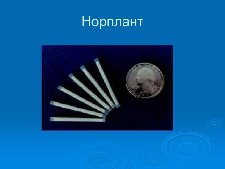 Норплант 