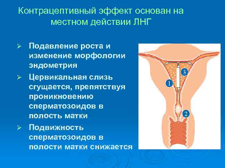 Контрацептивный эффект основан на местном действии ЛНГ Подавление роста и изменение морфологии эндометрия Ø