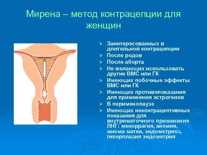 Мирена – метод контрацепции для женщин Ø Ø Ø Ø Заинтересованных в длительной контрацепции