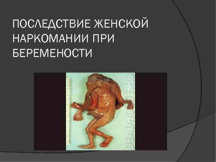 ПОСЛЕДСТВИЕ ЖЕНСКОЙ НАРКОМАНИИ ПРИ БЕРЕМЕНОСТИ 