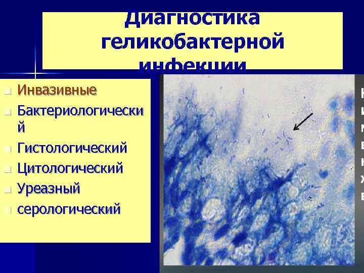 Диагностика геликобактерной инфекции n n n Инвазивные Бактериологически й Гистологический Цитологический Уреазный серологический 