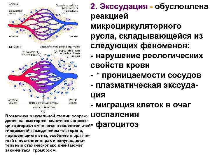 Какие процессы предшествуют экссудации см схему