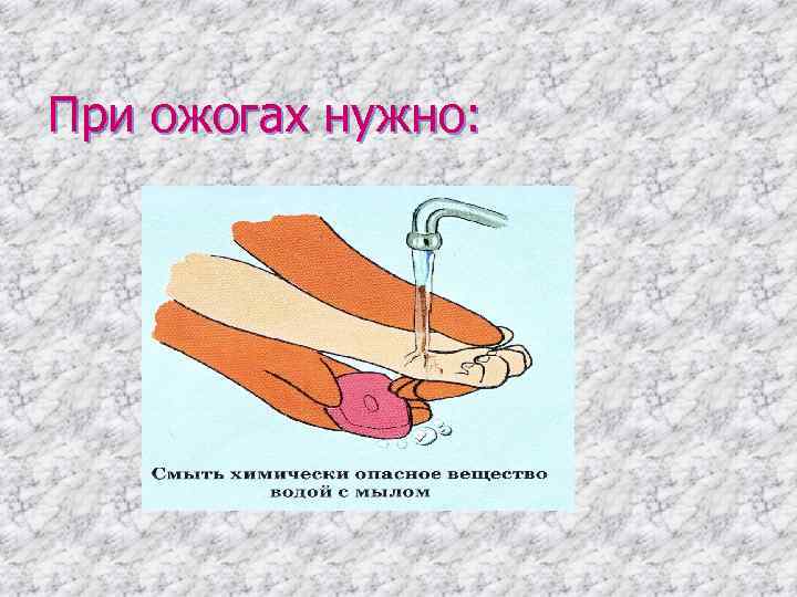 При ожогах нужно: 