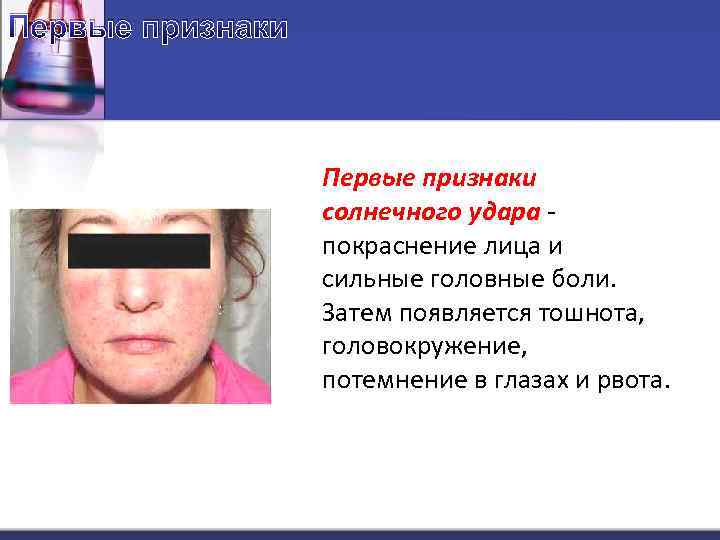 Первые признаки солнечного удара - покраснение лица и сильные головные боли. Затем появляется тошнота,