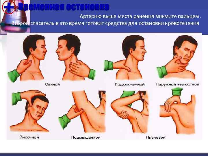 + Временная остановка Артерию выше места ранения зажмите пальцем. Второй спасатель в это время