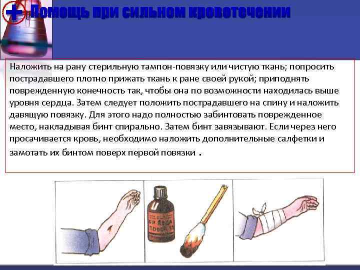 + Помощь при сильном кровотечении Наложить на рану стерильную тампон-повязку или чистую ткань; попросить
