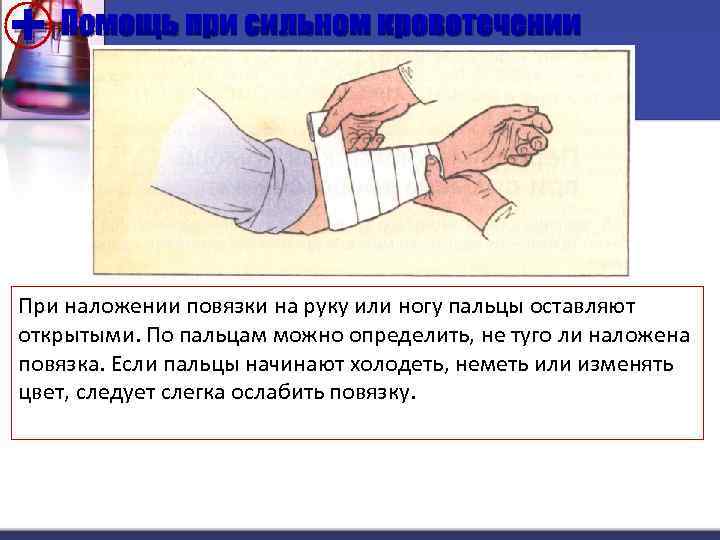 + Помощь при сильном кровотечении При наложении повязки на руку или ногу пальцы оставляют