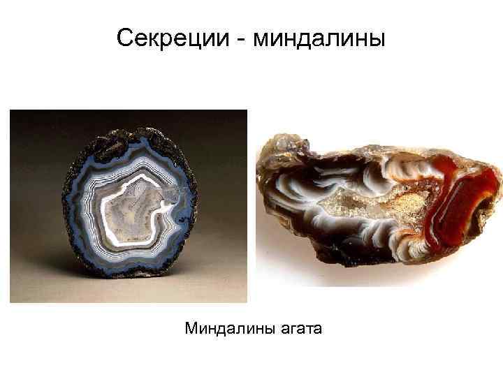 Секреции - миндалины Миндалины агата 