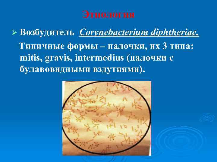 Этиология Ø Возбудитель Corynebacterium diphtheriae. Типичные формы – палочки, их 3 типа: mitis, gravis,