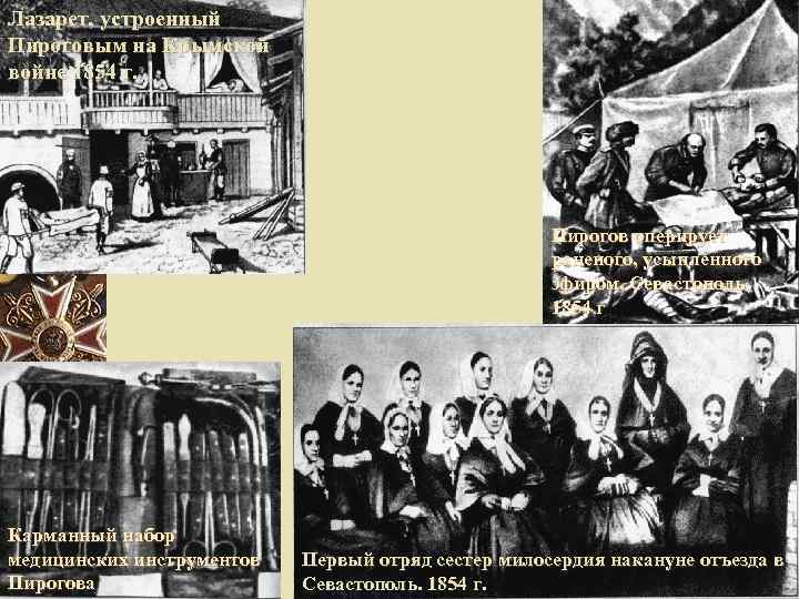 Лазарет, устроенный Пироговым на Крымской войне 1854 г. Пирогов оперирует раненого, усыпленного эфиром. Севастополь,