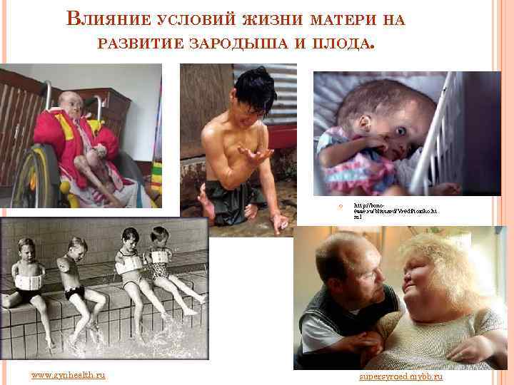 ВЛИЯНИЕ УСЛОВИЙ ЖИЗНИ МАТЕРИ НА РАЗВИТИЕ ЗАРОДЫША И ПЛОДА. www. gynhealth. ru http: //bonoesse.