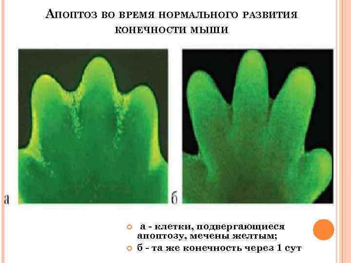 АПОПТОЗ ВО ВРЕМЯ НОРМАЛЬНОГО РАЗВИТИЯ КОНЕЧНОСТИ МЫШИ а - клетки, подвергающиеся апоптозу, мечены желтым;