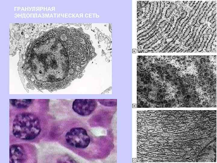 ГРАНУЛЯРНАЯ ЭНДОПЛАЗМАТИЧЕСКАЯ СЕТЬ 