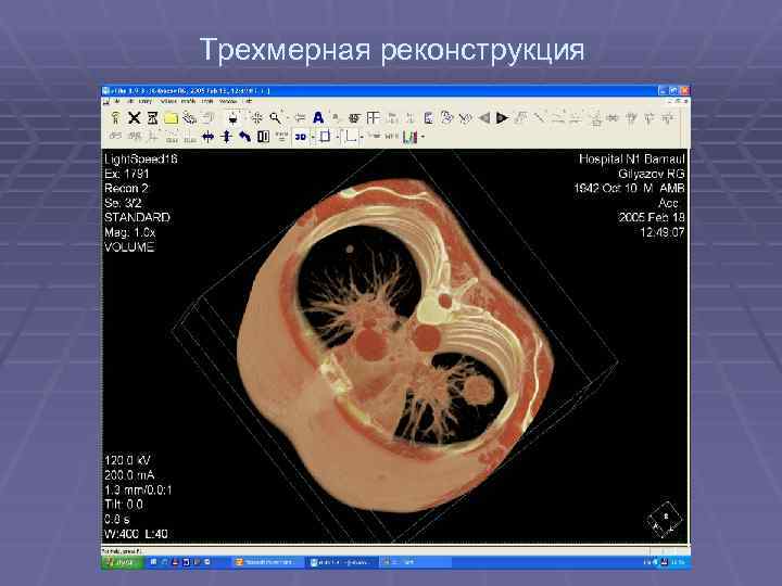 Трехмерная реконструкция 